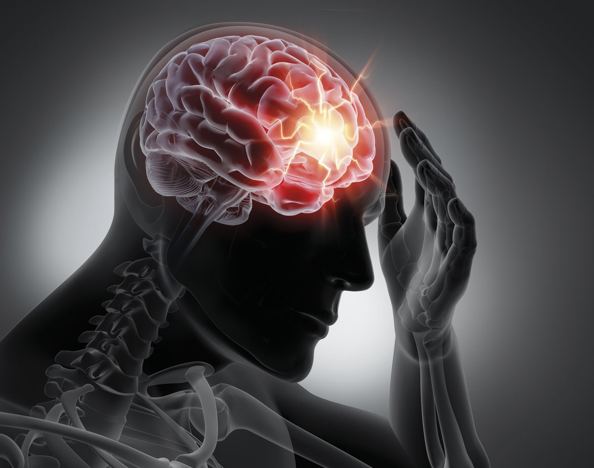 Neuroprotection for stroke: renewed hope for success - Medical Forum