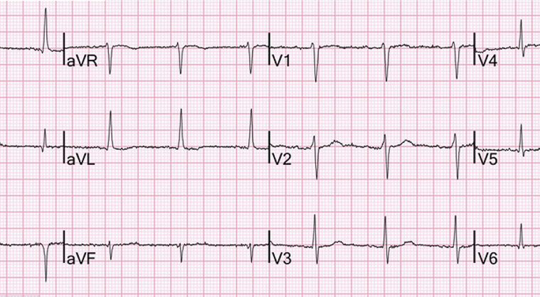 Man v Machine: Beware the computer-generated ECG report - Medical Forum