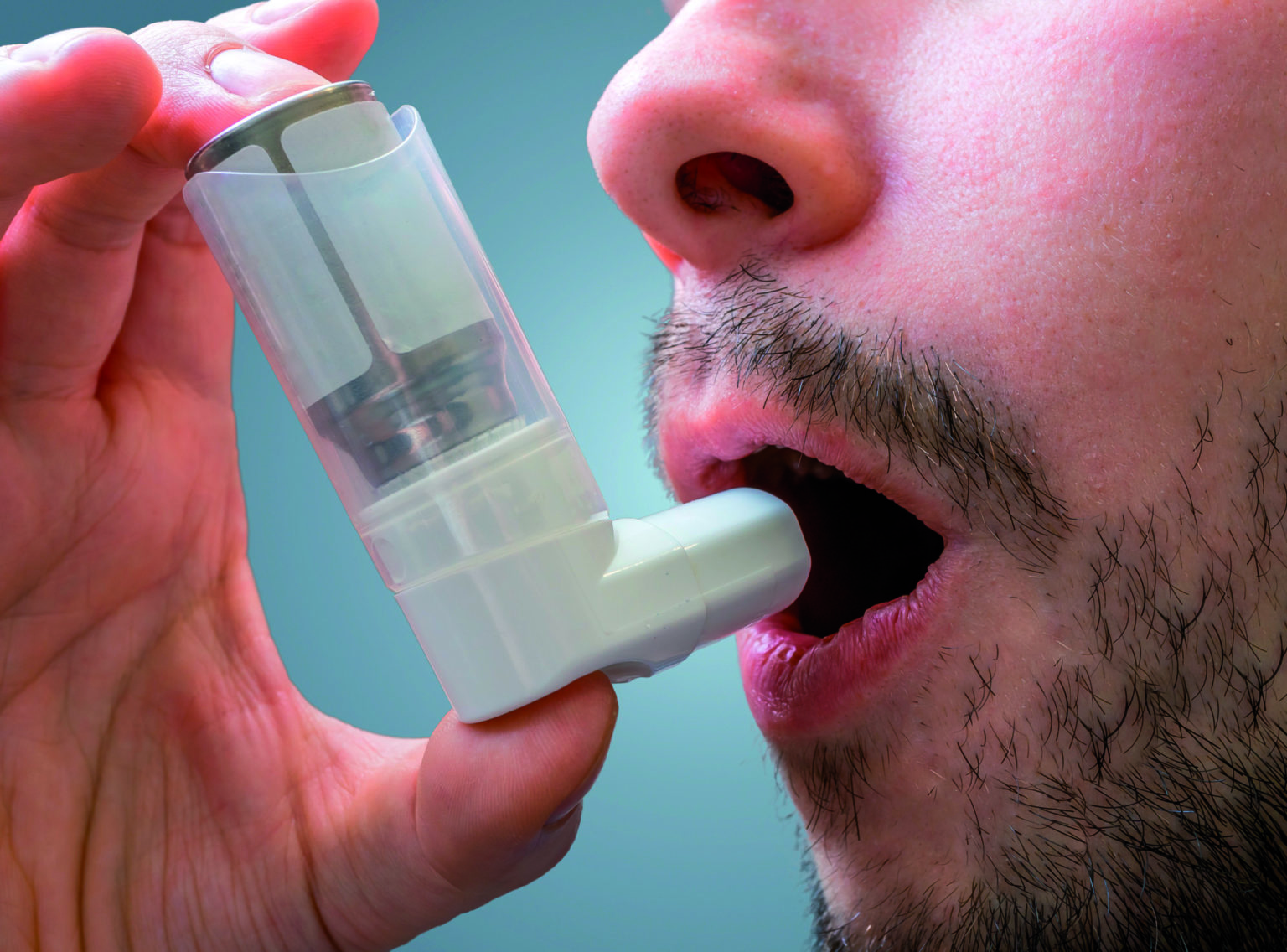 Australian Asthma Guidelines updated Medical Forum