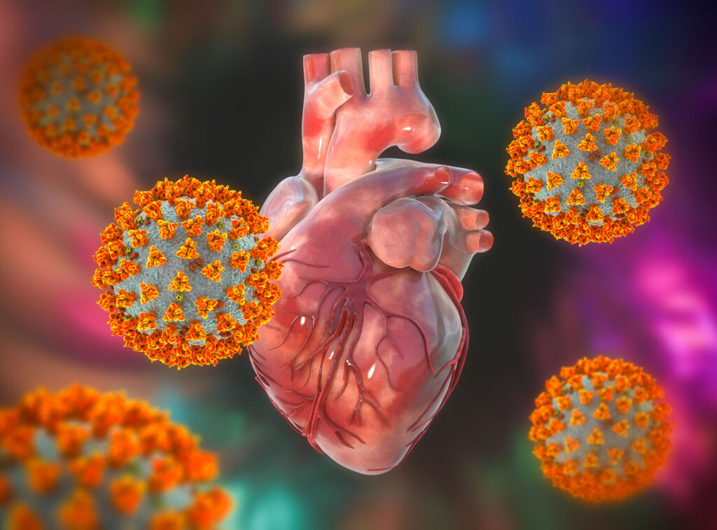 Vaccine myocarditis in aussie teens medical forum