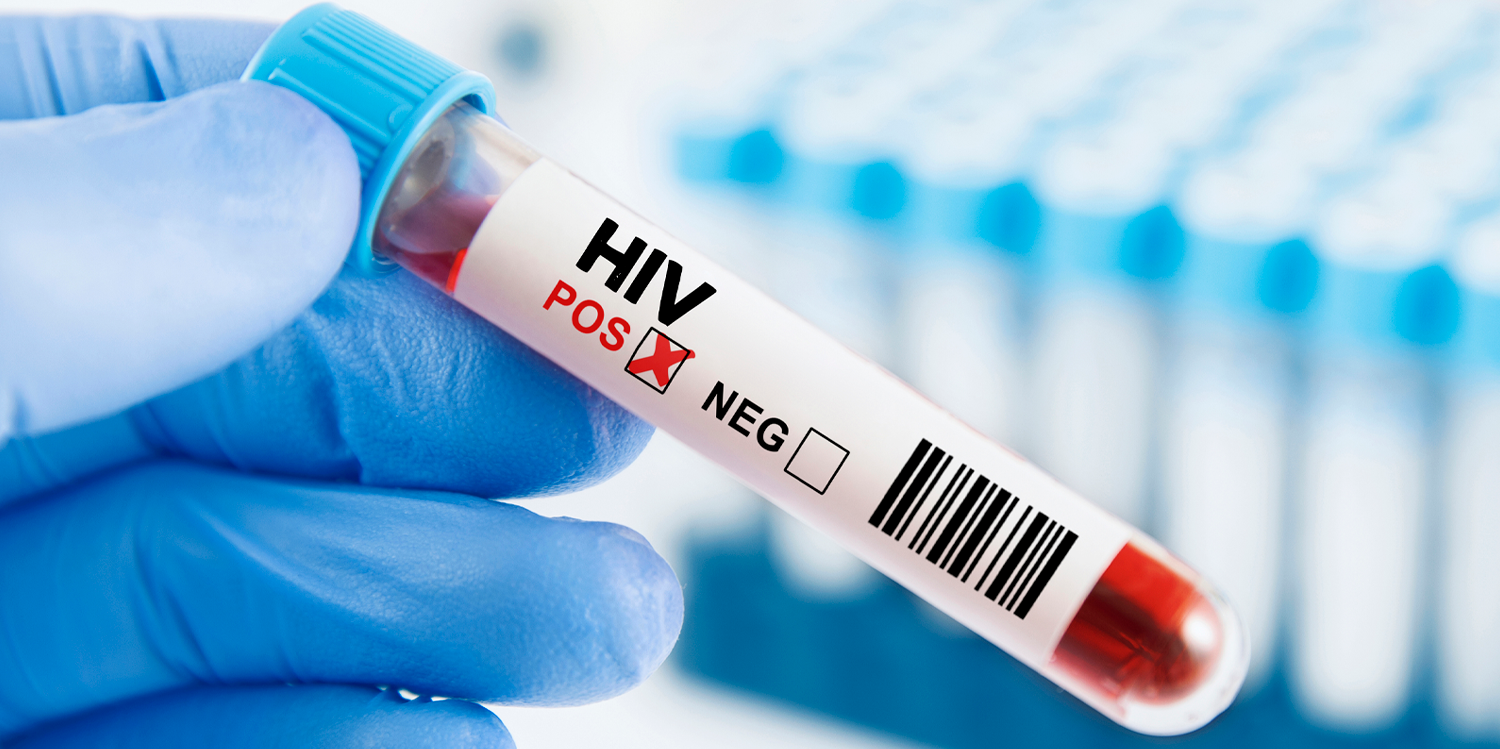 Recent data from the WA Department of Health show HIV notifications increased from 68 in 2023 to 77 in 2024.
