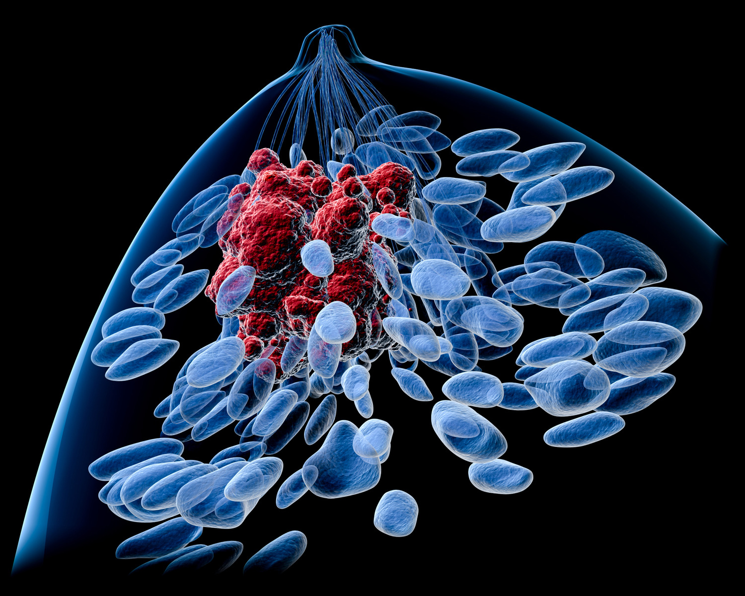 Breast density is not related to breast size or the ‘breast aware’ message, but it can make it harder to spot cancer on a mammogram.