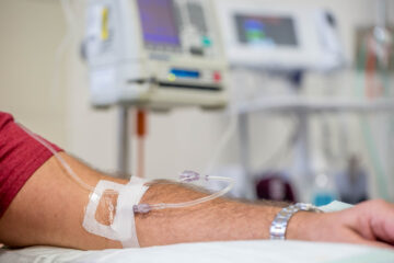 A patient's arm with machines in the background.
